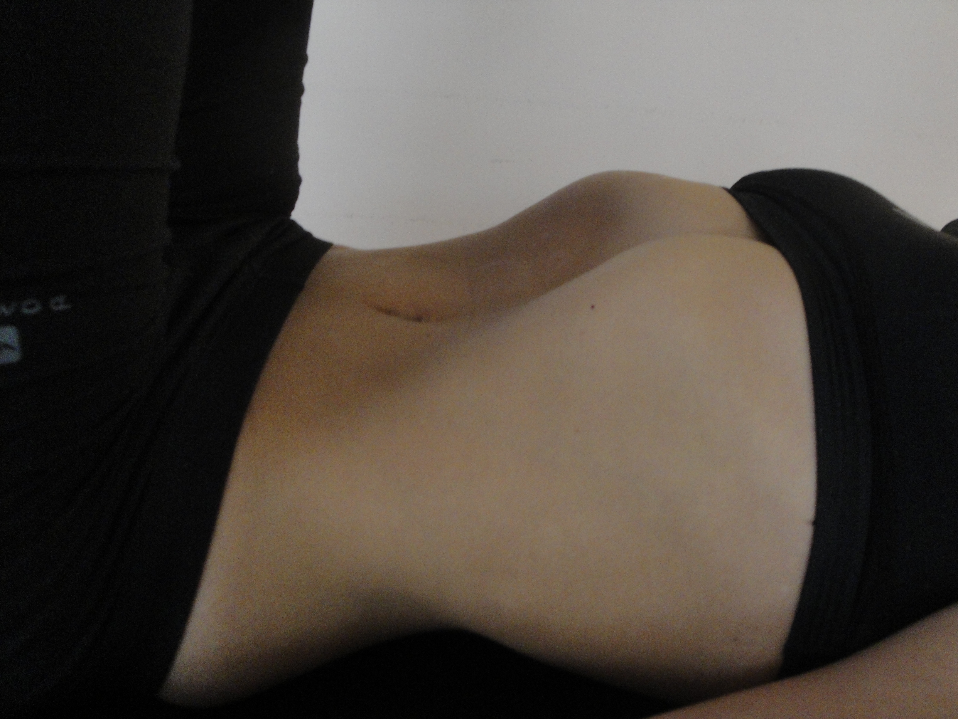 Comparación de la activación muscular durante los abdominales hipopresivos y el método Pilates